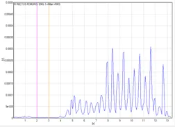 EMG signal analysis chart