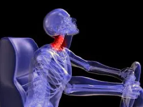 Award-winning research poster on neck muscle modeling